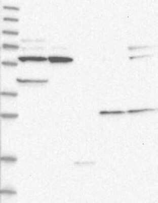 Western Blot: CTNNBL1 Antibody [NBP3-17825] - Lane 1: Marker [kDa] 230, 130, 95, 72, 56, 36, 28, 17, 11;   Lane 2: RT4;   Lane 3: U-251 MG;   Lane 4: Human Plasma;   Lane 5: Liver;   Lane 6: Tonsil