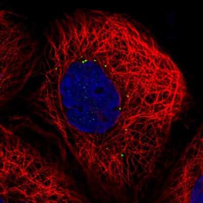 Immunocytochemistry/Immunofluorescence: CTNS Antibody [NBP2-56839] - Staining of human cell line A-431 shows localization to vesicles.