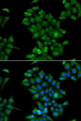 Immunocytochemistry/Immunofluorescence: CTNS Antibody [NBP3-04418] - Analysis of HeLa cells using CTNS antibody . Blue: DAPI for nuclear staining.