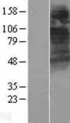 Western Blot CTNS Overexpression Lysate