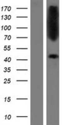 Western Blot CTNS Overexpression Lysate