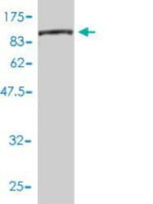 Western Blot: CTP synthase Antibody (2G7-1D10) [H00001503-M01] - Western Blot detection against Immunogen (90.75 KDa) . 