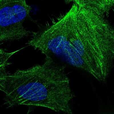 Immunocytochemistry/ Immunofluorescence CTP synthase Antibody - BSA Free
