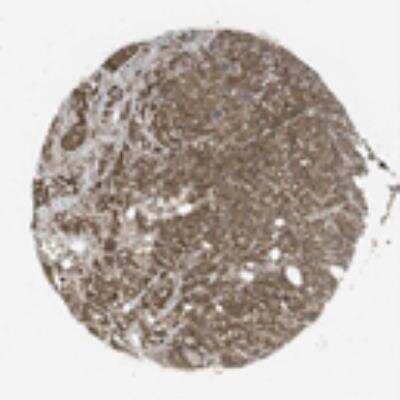 Immunohistochemistry: CTP synthase Antibody [23370002] - Moderate to strong cytoplasmic immunoreactivity, occasionally combined with nuclear positivity, was observed in normal and malignant tissues. Most glandular epithelia, cells of the central nervous system and renal tubuli displayed strong cytoplasmic staining. Most cases of colo-rectal, prostate and breast cancers showed strong cytoplasmic expression.  Image and statement courtesy of the Human Protein Atlas (HPA).