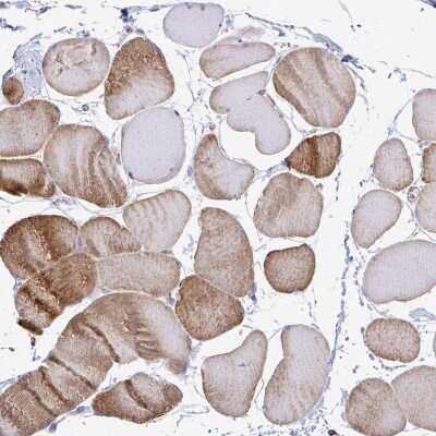 Immunohistochemistry-Paraffin: CTP synthase Antibody [NBP2-57099] - Staining of human skeletal muscle shows low expression as expected.