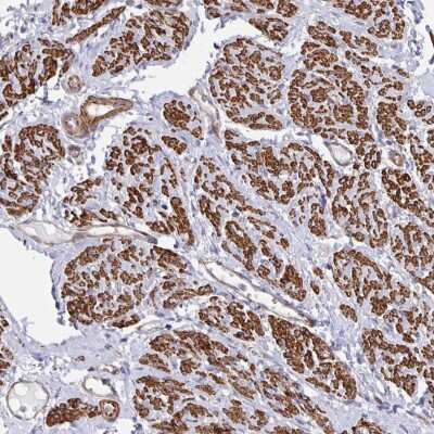 Immunohistochemistry-Paraffin: CTP synthase Antibody [NBP2-57099] - Staining of human smooth muscle shows high expression.
