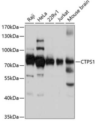 Western Blot: CTP synthase Antibody [NBP2-92435] - Analysis of extracts of various cell lines, using CTP synthase at 1:3000 dilution.Secondary antibody: HRP Goat Anti-Rabbit IgG (H+L) at 1:10000 dilution.Lysates/proteins: 25ug per lane.Blocking buffer: 3% nonfat dry milk in TBST.Detection: ECL Basic Kit .Exposure time: 5s.