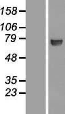 Western Blot: CTP synthase Overexpression Lysate (Adult Normal) [NBL1-09580] Left-Empty vector transfected control cell lysate (HEK293 cell lysate); Right -Over-expression Lysate for CTP synthase.