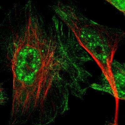 Immunocytochemistry/Immunofluorescence: CTR2 Antibody [NBP1-85512] - Staining  human cell line U-251 MG shows positivity in cytoplasm, intermediate filaments and nucleus but excluded from the nucleoli. Antibody staining is shown in green.