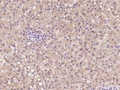 Immunohistochemistry-Paraffin: CTR2 Antibody [NBP2-97266] - Immunochemical staining of human CTR2 in human liver with rabbit polyclonal antibody at 1:100 dilution, formalin-fixed paraffin embedded sections.