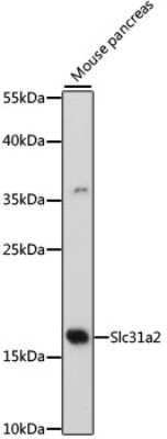 Western Blot: CTR2 Antibody [NBP2-92317] - Analysis of extracts of mouse pancreas, using CTR2 at 1:500 dilution.Secondary antibody: HRP Goat Anti-Rabbit IgG (H+L) at 1:10000 dilution.Lysates/proteins: 25ug per lane.Blocking buffer: 3% nonfat dry milk in TBST.Detection: ECL Basic Kit .Exposure time: 90s.