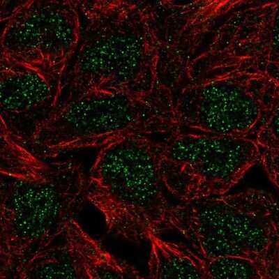 Immunocytochemistry/Immunofluorescence: CTR9 Antibody [NBP2-49547] - Staining of human cell line RT4 shows localization to nucleoplasm.