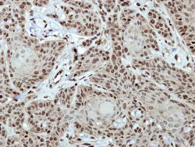 Immunohistochemistry-Paraffin: CTR9 Antibody [NBP2-16031] - Immunohistochemical analysis of paraffin-embedded Cal27 xenograft, using antibody at 1:500 dilution.