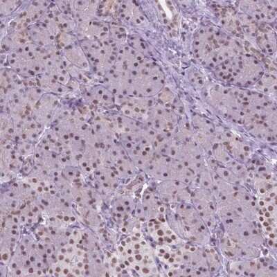 Immunohistochemistry-Paraffin: CTR9 Antibody [NBP2-49547] - Staining of human pancreas shows low expression as expected.