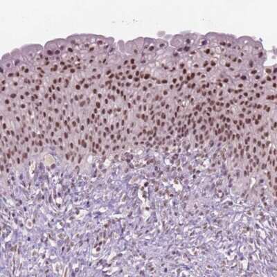 Immunohistochemistry-Paraffin: CTR9 Antibody [NBP2-49547] - Staining of human urinary bladder shows high expression.