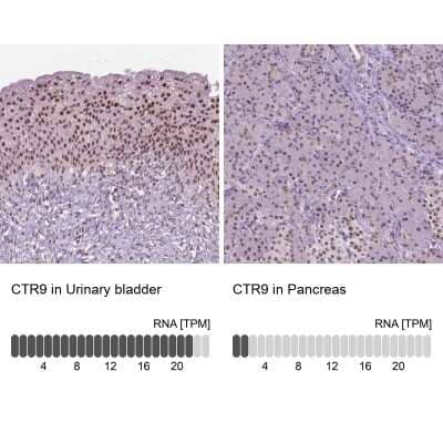 Immunohistochemistry-Paraffin: CTR9 Antibody [NBP2-49547] - Staining in human urinary bladder and pancreas tissues using anti-CTR9 antibody. Corresponding CTR9 RNA-seq data are presented for the same tissues.