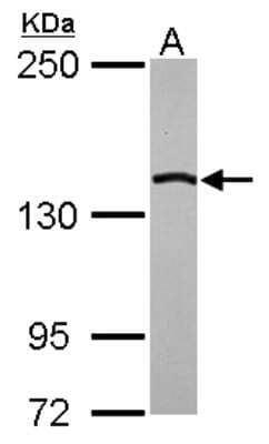 Western Blot: CTR9 Antibody [NBP2-16031] - Sample (30 ug of whole cell lysate) A: A431 5% SDS PAGE gel, diluted at 1:1000.