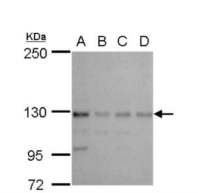 Western Blot CTR9 Antibody