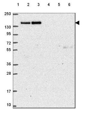 Western Blot CTR9 Antibody