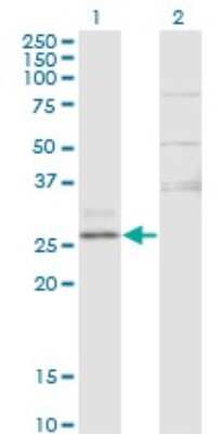 Western Blot: CTRB1 Antibody (3C8) [H00001504-M02] - Analysis of CTRB1 expression in transfected 293T cell line by CTRB1 monoclonal antibody (M02), clone 3C8.Lane 1: CTRB1 transfected lysate (Predicted MW: 27.9 KDa).Lane 2: Non-transfected lysate.