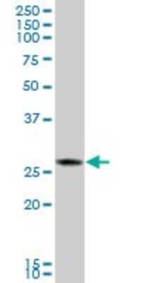 Western Blot: CTRB1 Antibody [H00001504-B01P] - Analysis of CTRB1 expression in human pancreas.