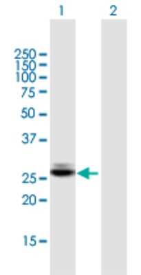 Western Blot: CTRB1 Antibody [H00001504-B01P] - Analysis of CTRB1 expression in transfected 293T cell line by CTRB1 polyclonal antibody.  Lane 1: CTRB1 transfected lysate(28.93 KDa). Lane 2: Non-transfected lysate.