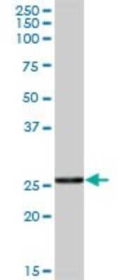 Western Blot CTRB1 Antibody - Azide and BSA Free
