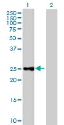 Western Blot: CTRB1 Antibody [H00001504-B02P] - Analysis of CTRB1 expression in transfected 293T cell line by CTRB1 polyclonal antibody.  Lane 1: CTRB1 transfected lysate(28.93 KDa). Lane 2: Non-transfected lysate.