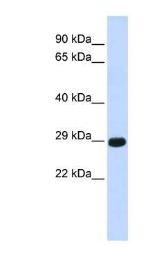 Western Blot: CTRB1 Antibody [NBP1-62678] - Titration: 0.2-1 ug/ml, Positive Control: Human Muscle.