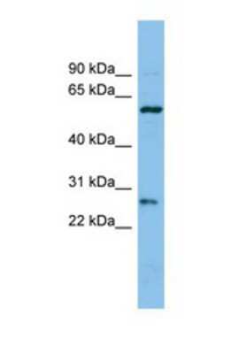 Western Blot: CTRB1 Antibody [NBP1-69669] - This Anti-CTRB1 antibody was used in Western Blot of COLO205       tissue lysate at a concentration of 1ug/ml.