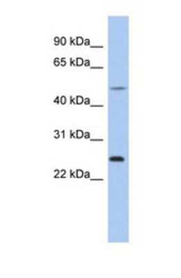 Western Blot: CTRB1 Antibody [NBP1-69699] - This Anti-CTRB1 antibody was used in Western Blot of THP-1     tissue lysate at a concentration of 1ug/ml.