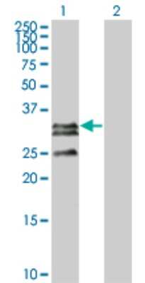 Western Blot: CTRP2 Antibody (1D7-2C7) [H00114898-M01] - Analysis of C1QTNF2 expression in transfected 293T cell line by C1QTNF2 monoclonal antibody (M01), clone 1D7-2C7.Lane 1: C1QTNF2 transfected lysate(32.775 KDa).Lane 2: Non-transfected lysate.