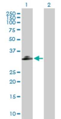 Western Blot: CTRP2 Antibody [H00114898-B01P] - Analysis of C1QTNF2 expression in transfected 293T cell line by C1QTNF2 polyclonal antibody.  Lane 1: C1QTNF2 transfected lysate(31.35 KDa). Lane 2: Non-transfected lysate.