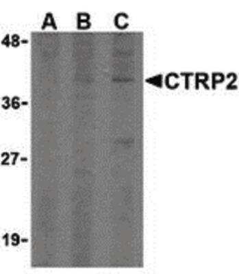 Western Blot: CTRP2 Antibody [NBP1-02999] - Western blot of CTRP2 in 3T3 (Balb) cell lysate with CTRP2 Antibody at (A) 1, (B) 2, and (C) 4 ug/ml.