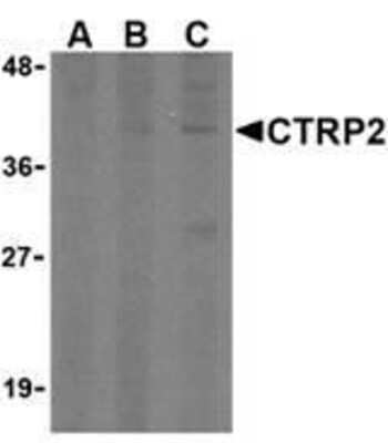 Western Blot: CTRP2 Antibody [NBP1-76627] - 3T3 (Balb) cell lysate with CTRP2 (IN) antibody at (A) 1, (B) 2, and (C) 4 ug/ml.