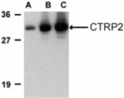 Western Blot CTRP2 Antibody - BSA Free