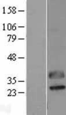 Western Blot: CTRP2 Overexpression Lysate (Adult Normal) [NBL1-08343] Left-Empty vector transfected control cell lysate (HEK293 cell lysate); Right -Over-expression Lysate for CTRP2.