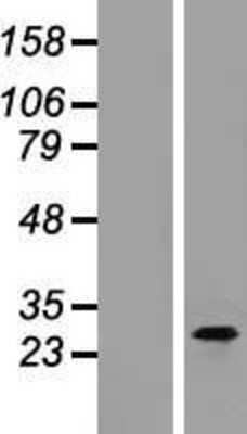 Western Blot C1qTNF3/CORS26/CTRP3 Overexpression Lysate