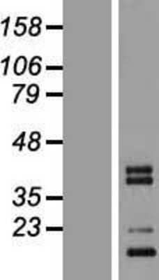 Western Blot C1qTNF3/CORS26/CTRP3 Overexpression Lysate