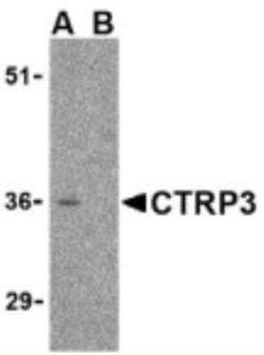 Western Blot C1qTNF3/CORS26/CTRP3 Antibody Blocking Peptide