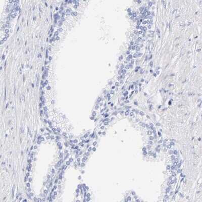 Immunohistochemistry-Paraffin: CTRP6 Antibody [NBP1-85381] - Staining of human prostate shows low expression as expected.