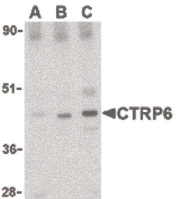 Western Blot: CTRP6 Antibody [NBP1-03121] - Mouse brain cell lysate with CTRP6 antibody at (A) 0.5, (B) 1 and (C) 2 ug/ml.