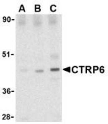 Western Blot CTRP6 Antibody - BSA Free