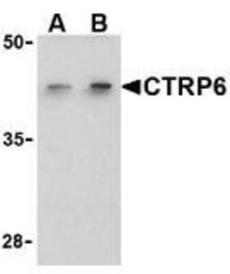 Western Blot: CTRP6 Antibody [NBP1-77218] - Analysis of CTRP6 in HeLa cell lysate with CTRP6 antibody using NBP1-77218 at (A) 1 and (B) 2 ug/ml.