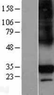 Western Blot: CTRP6 Overexpression Lysate (Adult Normal) [NBL1-08345] Left-Empty vector transfected control cell lysate (HEK293 cell lysate); Right -Over-expression Lysate for CTRP6.