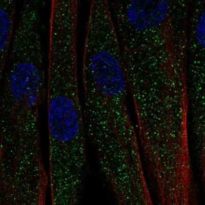 Immunocytochemistry/Immunofluorescence: CTRP7 Antibody [NBP2-68719] - Staining of human cell line ASC TERT1 shows localization to vesicles.