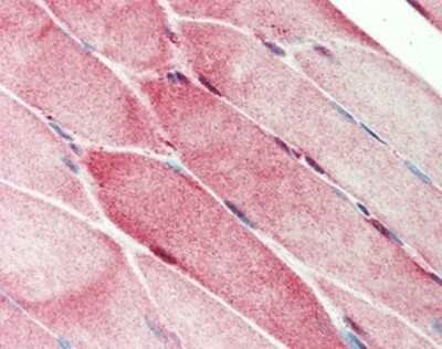 Immunohistochemistry-Paraffin: CTRP7 Antibody [NBP1-03064] - Staining of Formalin-Fixed Paraffin-Embedded (FFPE) human Skeletal muscle using NBP1-03064