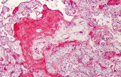 Immunohistochemistry-Paraffin: CTRP7 Antibody [NBP1-03064] - Staining of human placenta. Immunohistochemistry of formalin-fixed, paraffin-embedded tissue after heat-induced antigen retrieval. Antibody concentration 5 ug/ml.