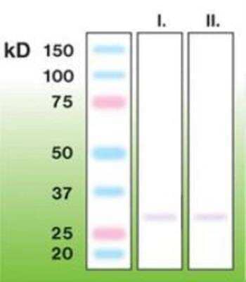 Western Blot: CTRP7 Antibody (K14-S) [NBP1-30132] - CTRP7 in Rat (I.) and Mouse (II.) brain crude lysates (200 ug of total protein loaded).