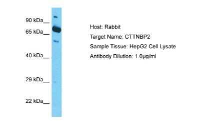 Western Blot CTTNBP2 Antibody